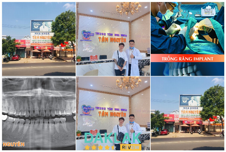 Nha Khoa Tâm Nguyên Đắk Lắk – Địa chỉ chăm sóc, điều trị và thẩm mỹ răng miệng uy tín tại Buôn Ma Thuột