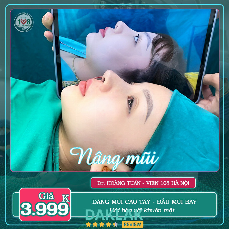 Khách hàng nâng mũi tại Viện Thẩm Mỹ 108 Buôn Ma Thuột, dáng mũi cao tây và đầu mũi bay hài hòa với gương mặt.