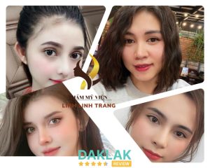 Kết quả làm đẹp thực tế tại Thẩm mỹ viện Linh Linh Trang Buôn Ma Thuột